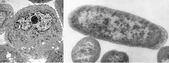 Figure 1: A eukaryotic cell (left) has membrane bound organelles, while a prokaryotic cell (right) does not.