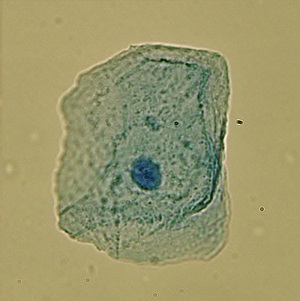 Figure 5: The nucleus containing DNA is clearly visible in this eukaryotic cell.
