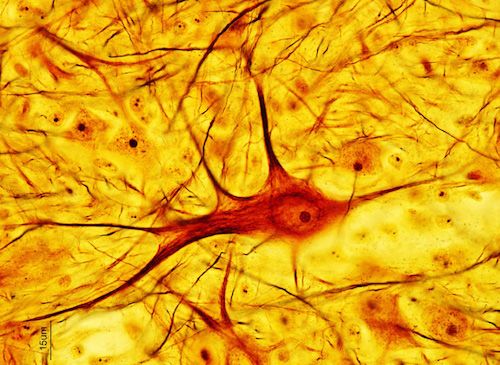 Figure 3: Neuron cell structures dyed with the "Golgi stain" method.