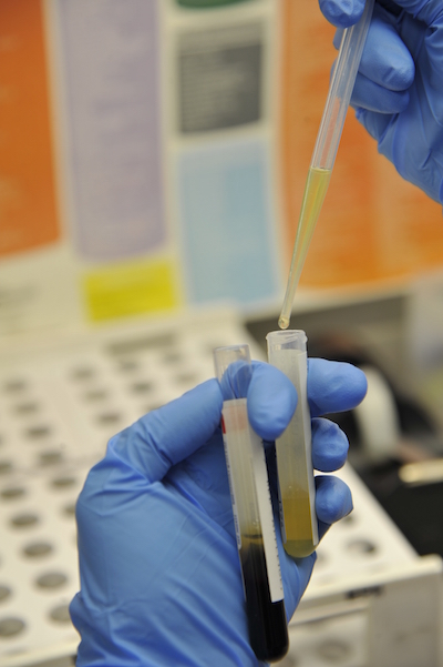 Figure 2: A researcher piping blood serum into a test tube.