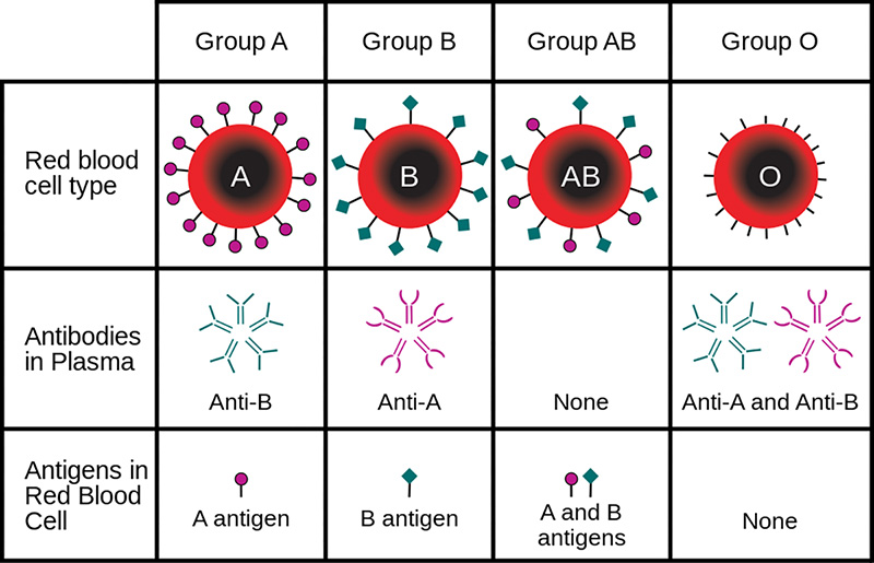 Figure 7: ABO blood groups and the antibodies and antigens present in each. This chart tells us that, for example, people with type A blood have the A antigen on the surface of their red cells and anti-B antibodies in their plasma. So if type B blood is mixed with this type A blood, the type A will attack the type B blood by agglutinating the introduced red cells. The same is true if type AB blood is added, but type O will not result in agglutination since it lacks the anti-B antigens on the cell surface.