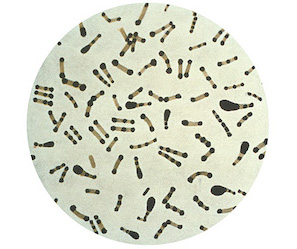 Figure 5: Photomicrograph of Corynebacterium diphtheriae.