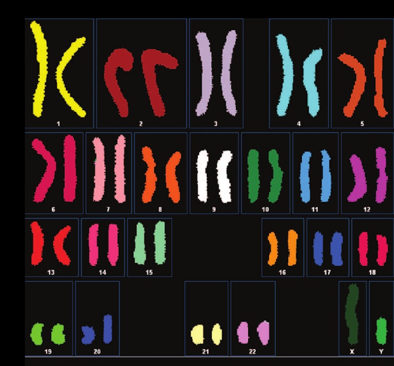 Figure 3: Depiction of a person’s complete set of chromosomes.