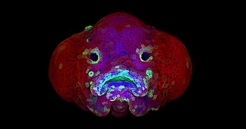 CC BY-NC 2.0 Oscar Ruiz and George Eisenhoffer, University of Texas MD Anderson Cancer Center, Houston